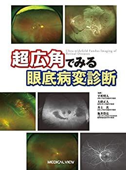 【未使用】【中古】 超広角でみる眼底病変診断?病巣を見逃さないために