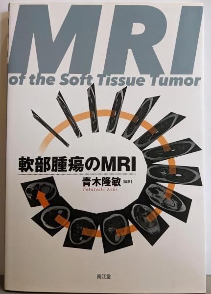 軟部腫瘍のMRI 青木 隆敏 著 青木 隆敏 編集 南江堂