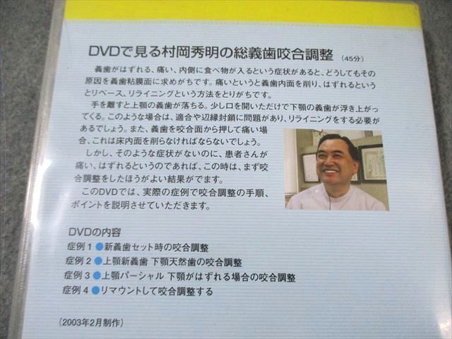 デンタルダイヤモンド社 DVDで見る村岡秀明の総義歯咬合調整 007s3D デンタルダイヤモンド社 DVDで見る村岡秀明の総義歯咬合調整