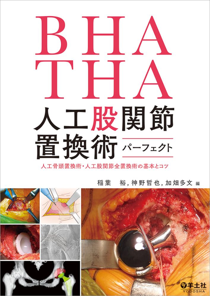 ＢＨＡ ＴＨＡ人工股関節置換術パーフェクト 人工骨頭置換術 人工股関節全置換術の基本とコツ|羊土社|稲葉裕 整形外科 単行本