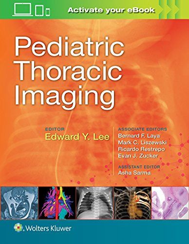 Pediatric Thoracic Imaging Edward Y. Lee MD MPH