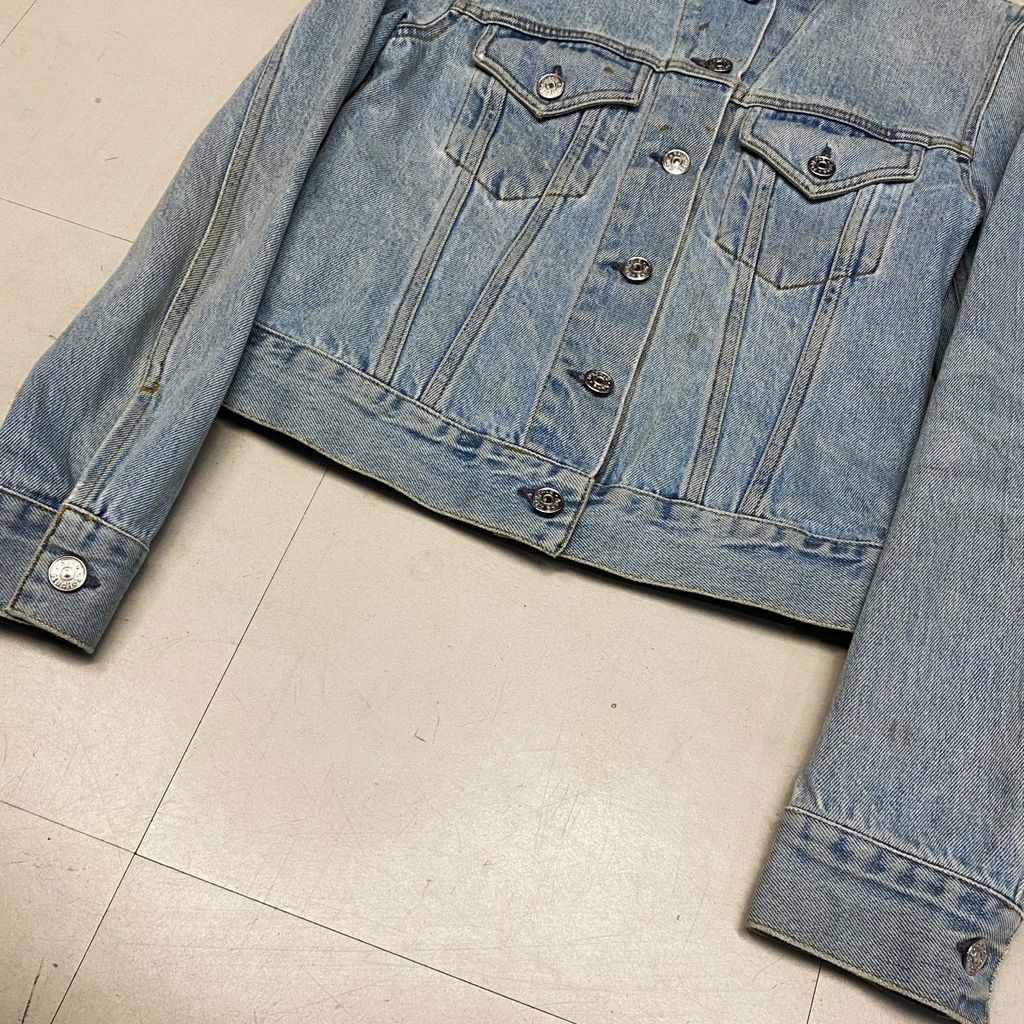 Acne