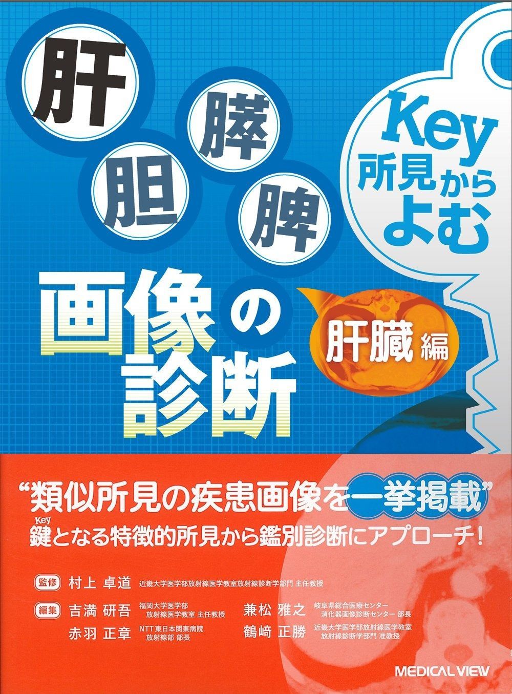  Key所見からよむ 肝胆膵脾の画像診断 肝臓編 その他