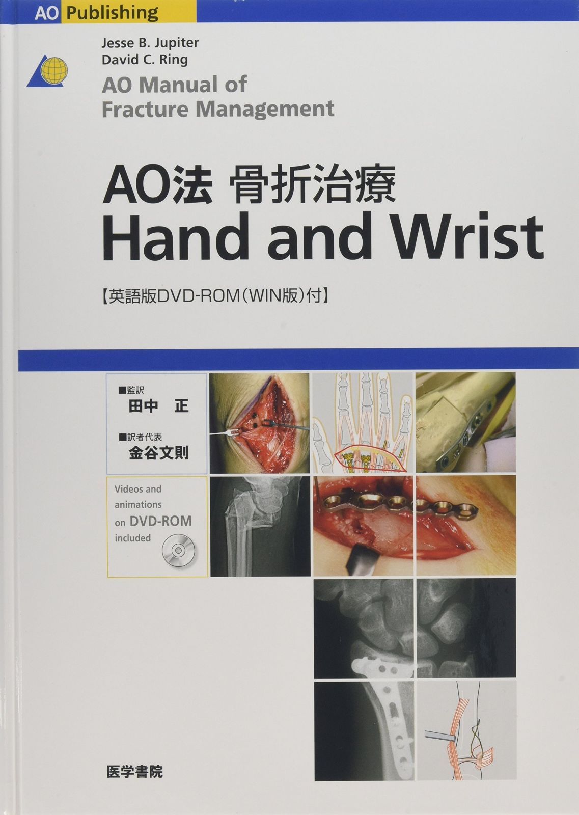 AO法骨折治療 Hand 本 (AOTRAUMA) 正: 田中 書籍 医学書院 書籍