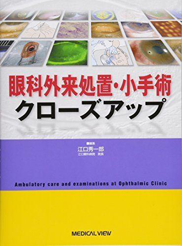 眼科外来処置 小手術クローズアップ