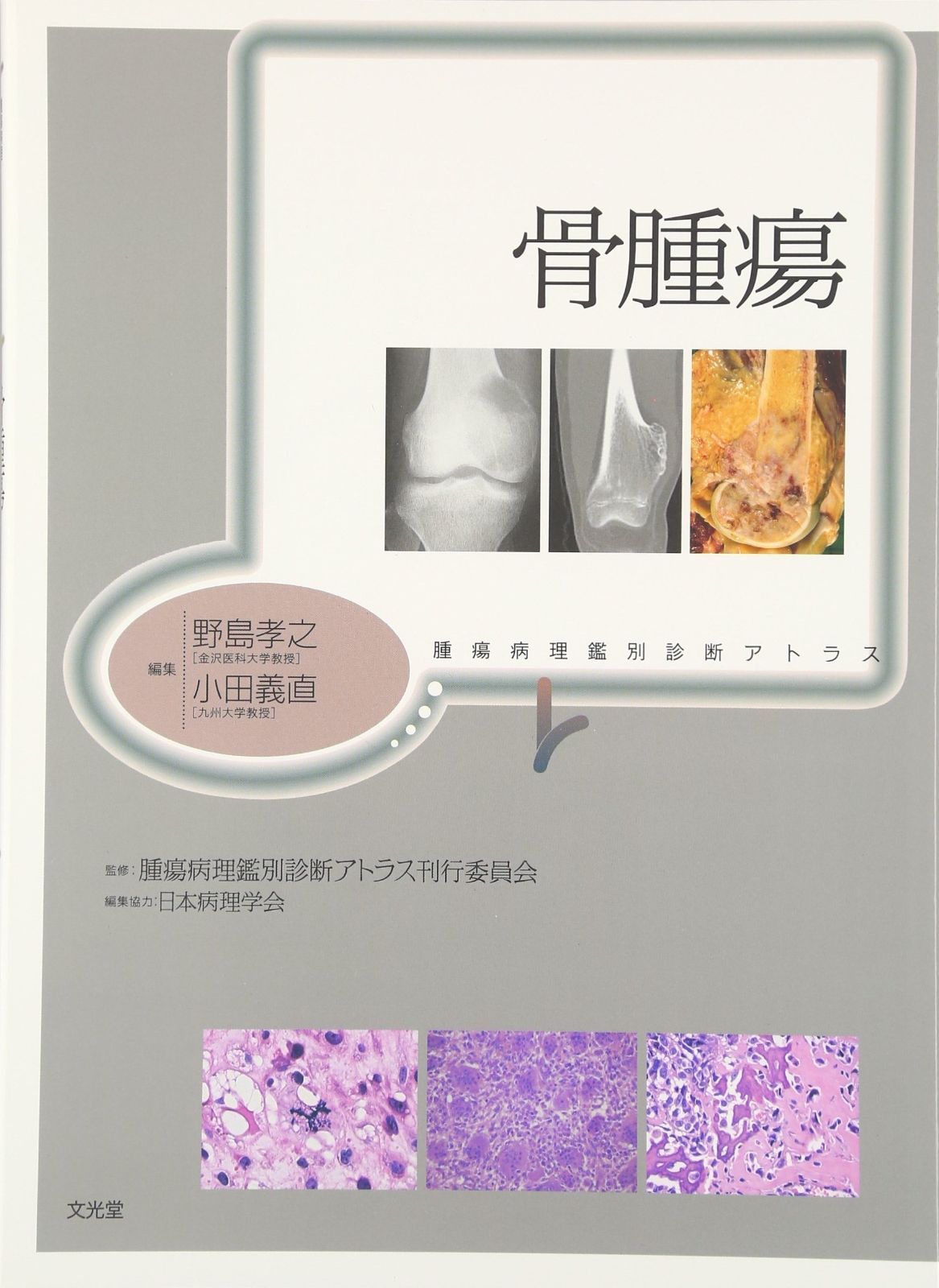 骨腫瘍: 腫瘍病理鑑別診断アトラス