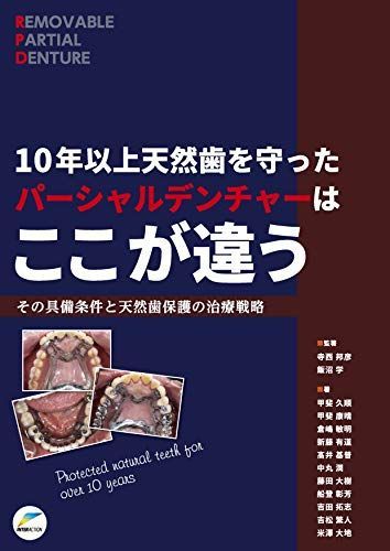 10年以上天然歯を守ったパーシャルデンチャーはここが違う: その具備条件と天然歯保護の治療戦略