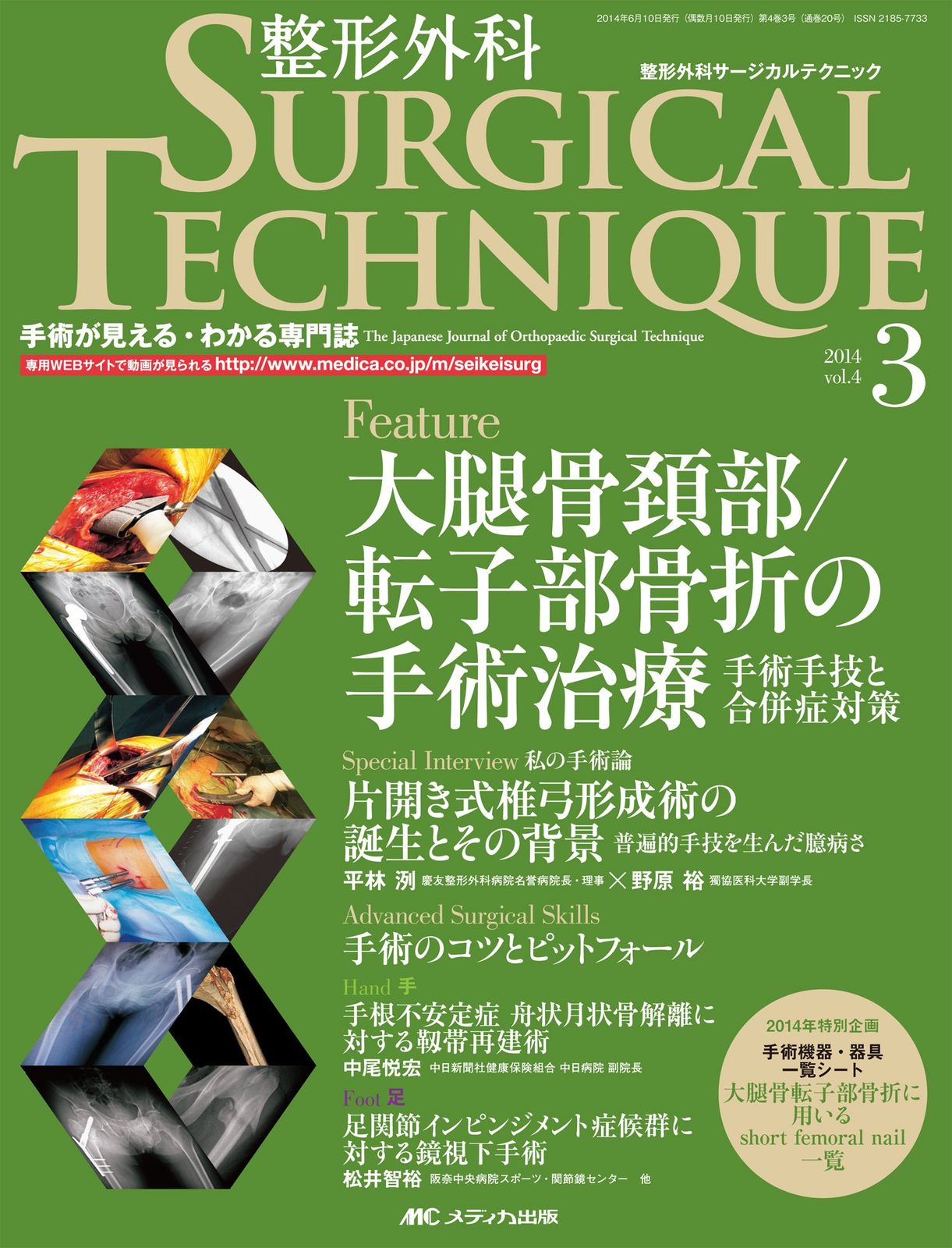 整形外科サージカルテクニック 2014年3号(第4巻3号) 特集:大腿骨頚部