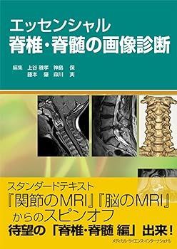【中古】(非常に良い)エッセンシャル脊椎・脊髄の画像診断 上谷雅孝