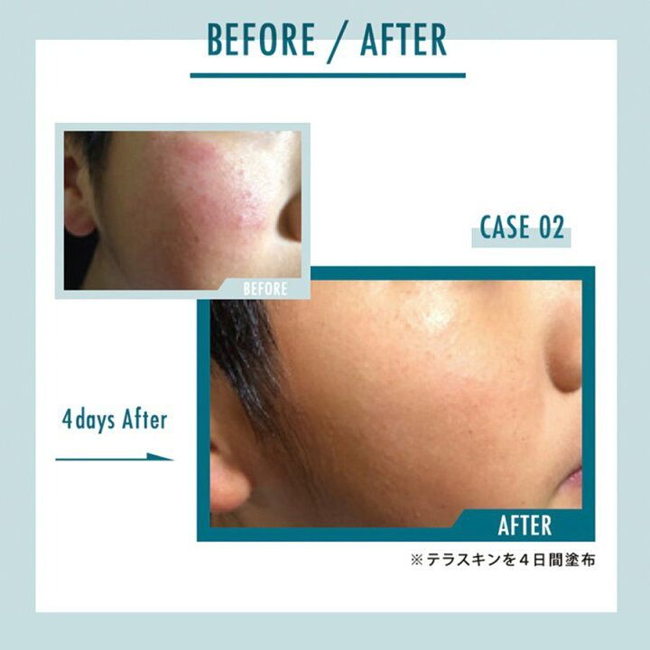 ラインリペア 30ml
