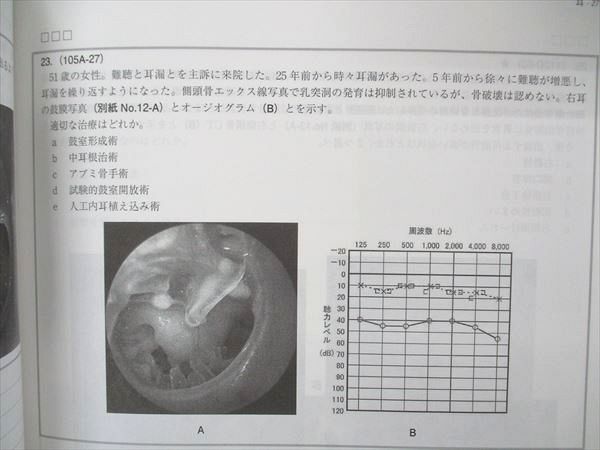 UQ04-047 MEC 医師国家試験対策 マイナー対策/メック臓器別/特別講座他