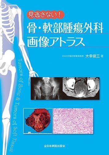 見逃さない! 骨・軟部腫瘍外科画像アトラス [単行本] 大幸 俊三