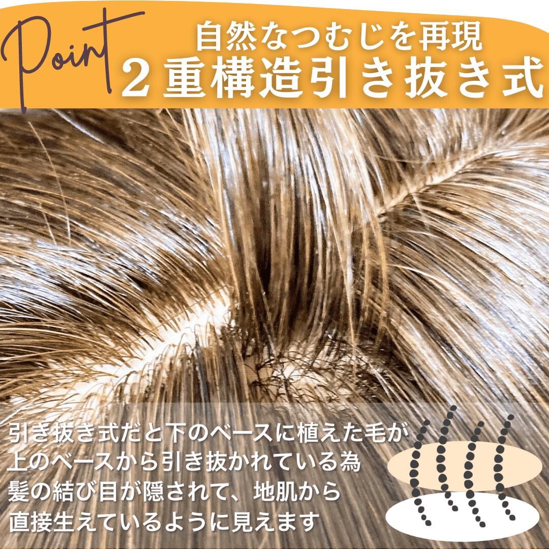 つむじ 頭頂部