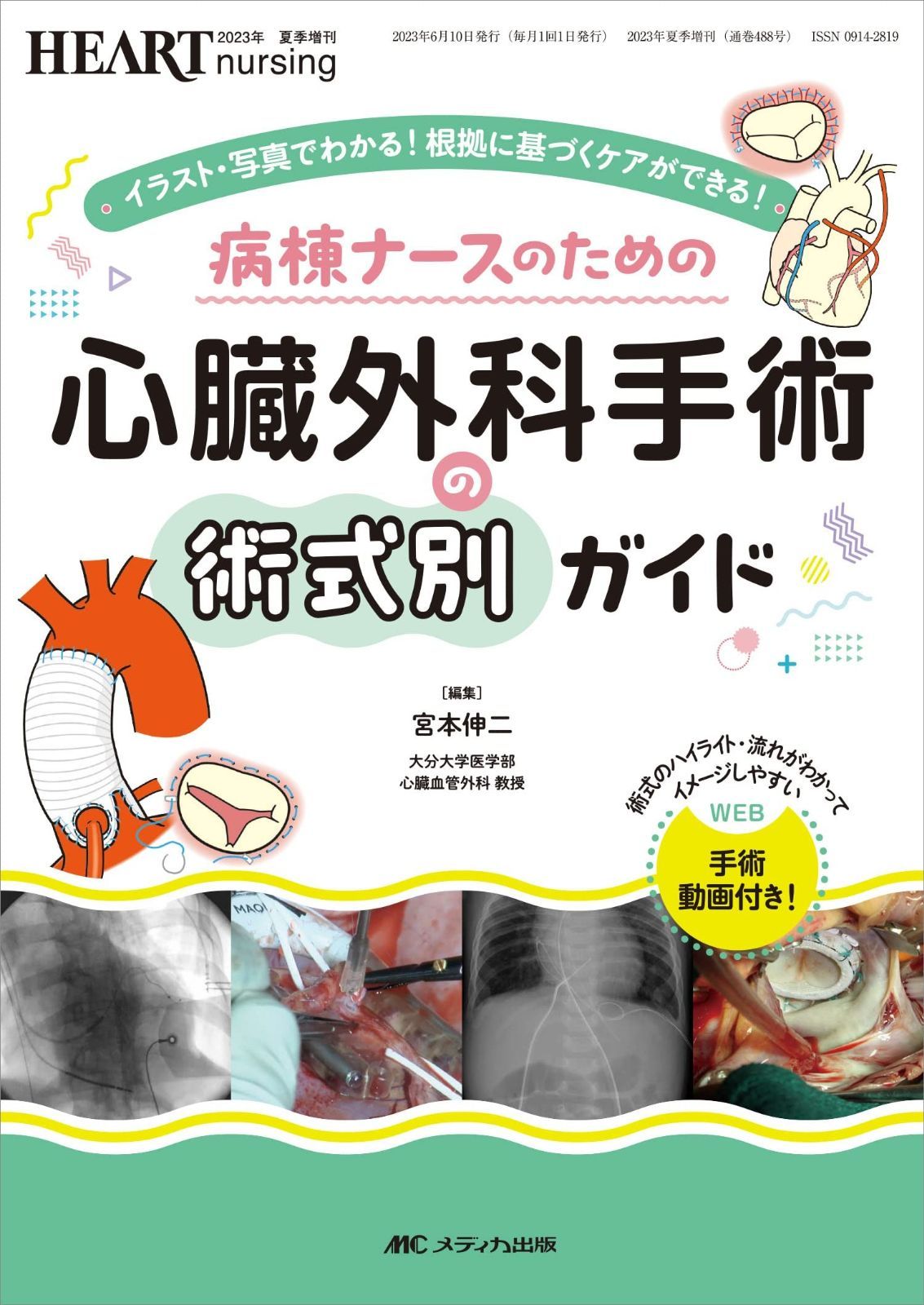 病棟ナースのための 心臓外科手術の術式別ガイド: イラスト・写真で