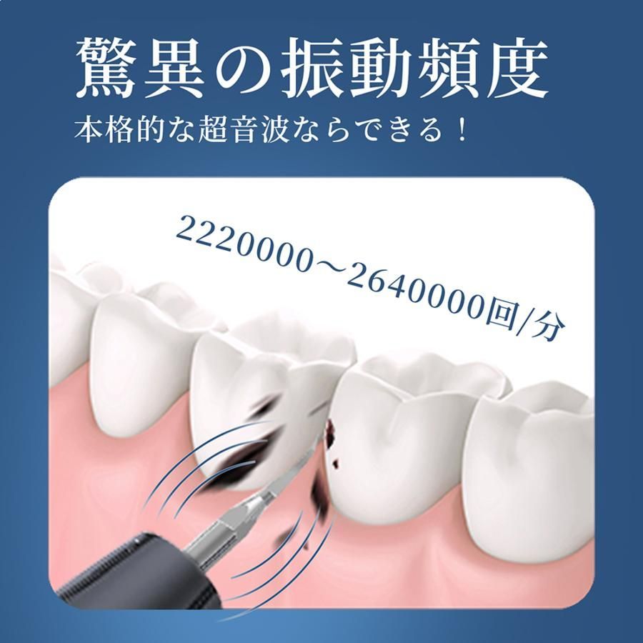 口腔洗浄器 ジェットウォッシャー 超音波 歯クリーナー 内蔵LEDライト