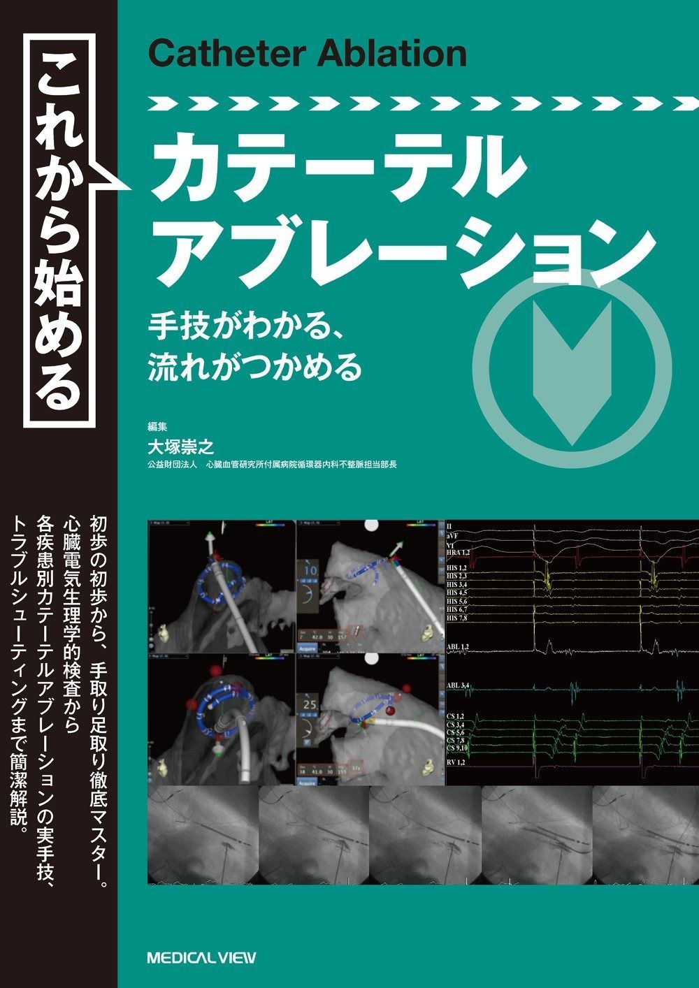 これから始めるカテーテルアブレーション?手技がわかる%ｶﾝﾏ%流れがつかめる