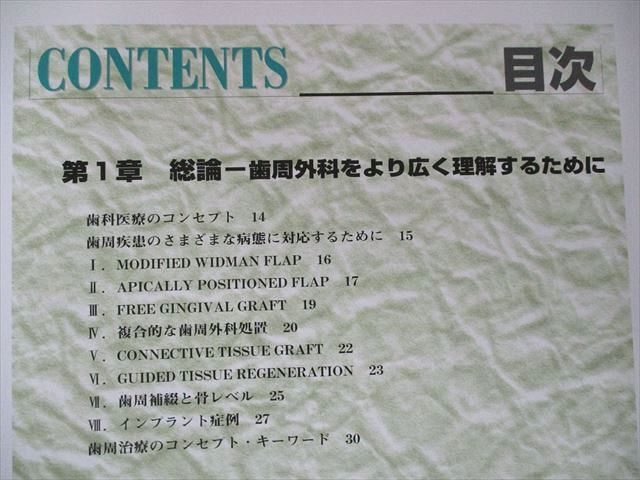 ポケモンレジェンズ】 コンセプトをもった予知性の高い歯周外科処置