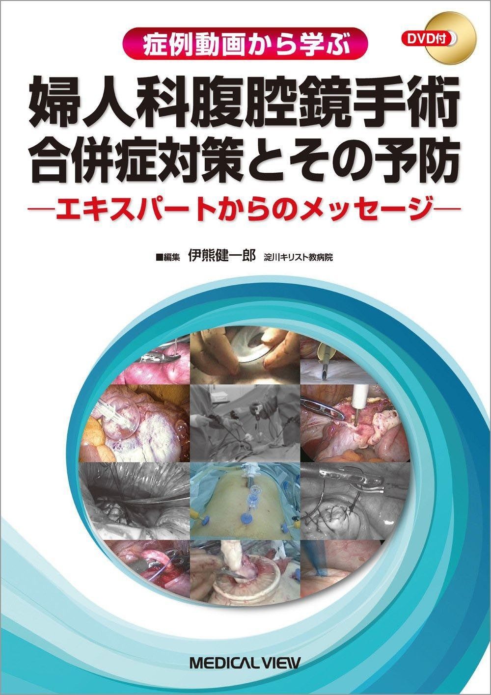 症例動画から学ぶ 婦人科腹腔鏡手術 合併症対策とその予防?エキスパートからのメッセージ