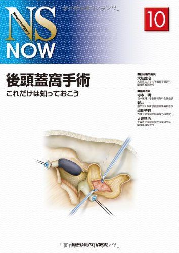 後頭蓋窩手術?これだけは知っておこう (NS NOW No.10) 大畑 建治