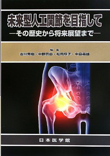 未来型人工関節を目指して: その歴史から将来展望まで 