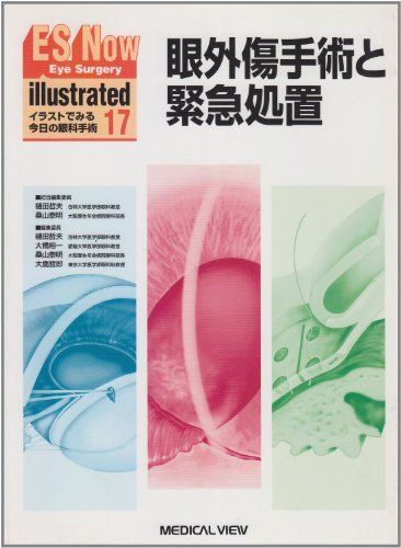 ES now illustrated no.17―イラストでみる今日の眼科手術 眼外傷手術と緊急処置 樋田 哲夫 ES now illustrated no.17―イラストでみる今日の眼科手術 眼外傷