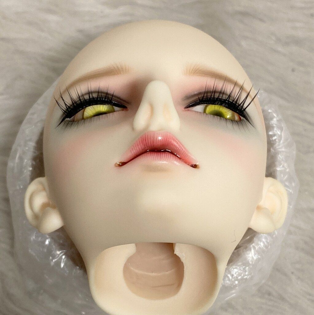 normal