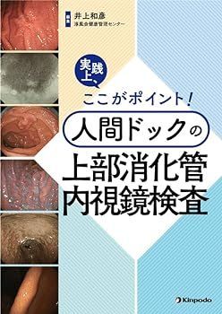 【中古】実践上、ここがポイント！　人間ドックの上部消化管内視鏡検査