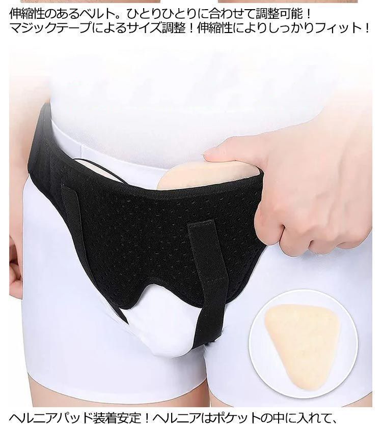 シングル 鼠径ヘルニア