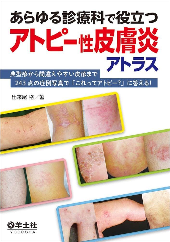 あらゆる診療科で役立つアトピー性皮膚炎アトラス?典型疹から間違えやすい皮疹まで243点の症例写真で「これってアトピー？」に答える！