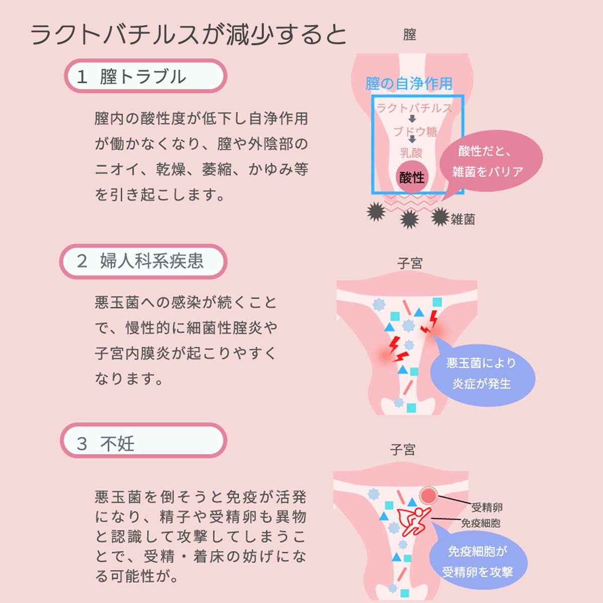 膣内ラクトバチルス検査
