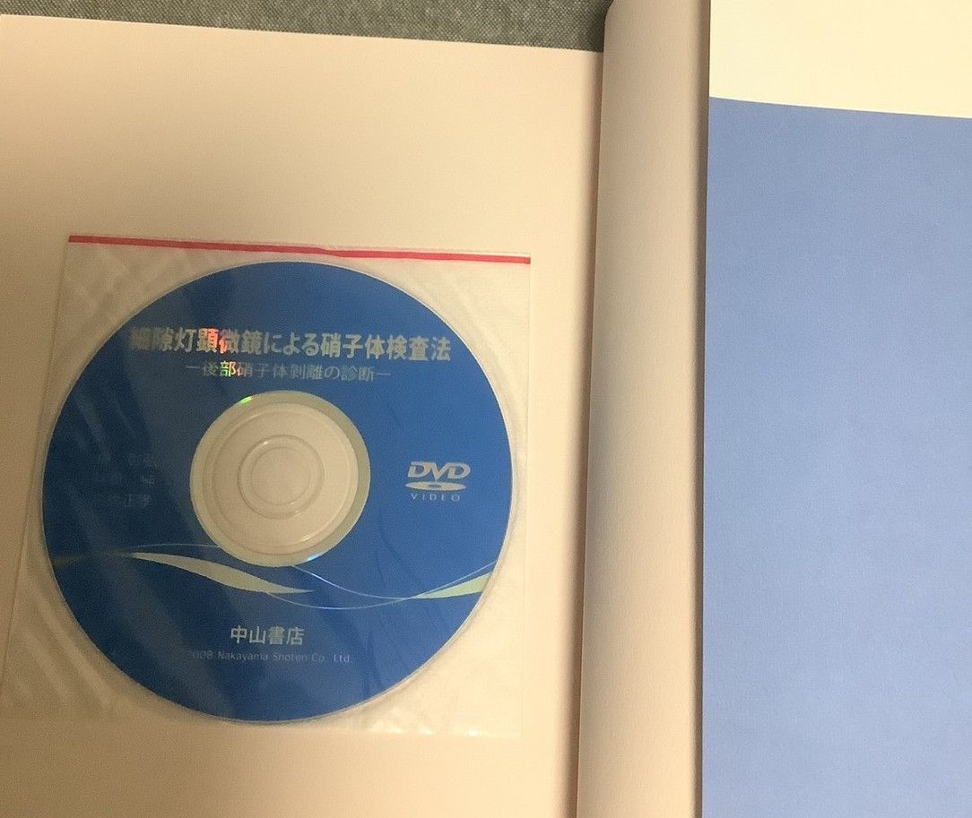 細隙灯顕微鏡による硝子体検査法 後部硝子体剥離の診断 梯 彰弘 細隙灯顕微鏡による硝子体検査法 後部硝子体剥離の診断 梯 彰弘