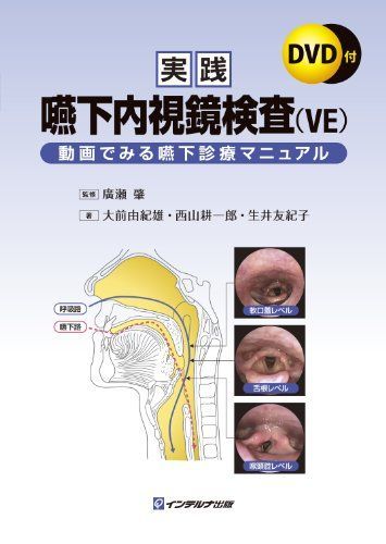 実践嚥下内視鏡検査(VE): 動画でみる嚥下診療マニュアル