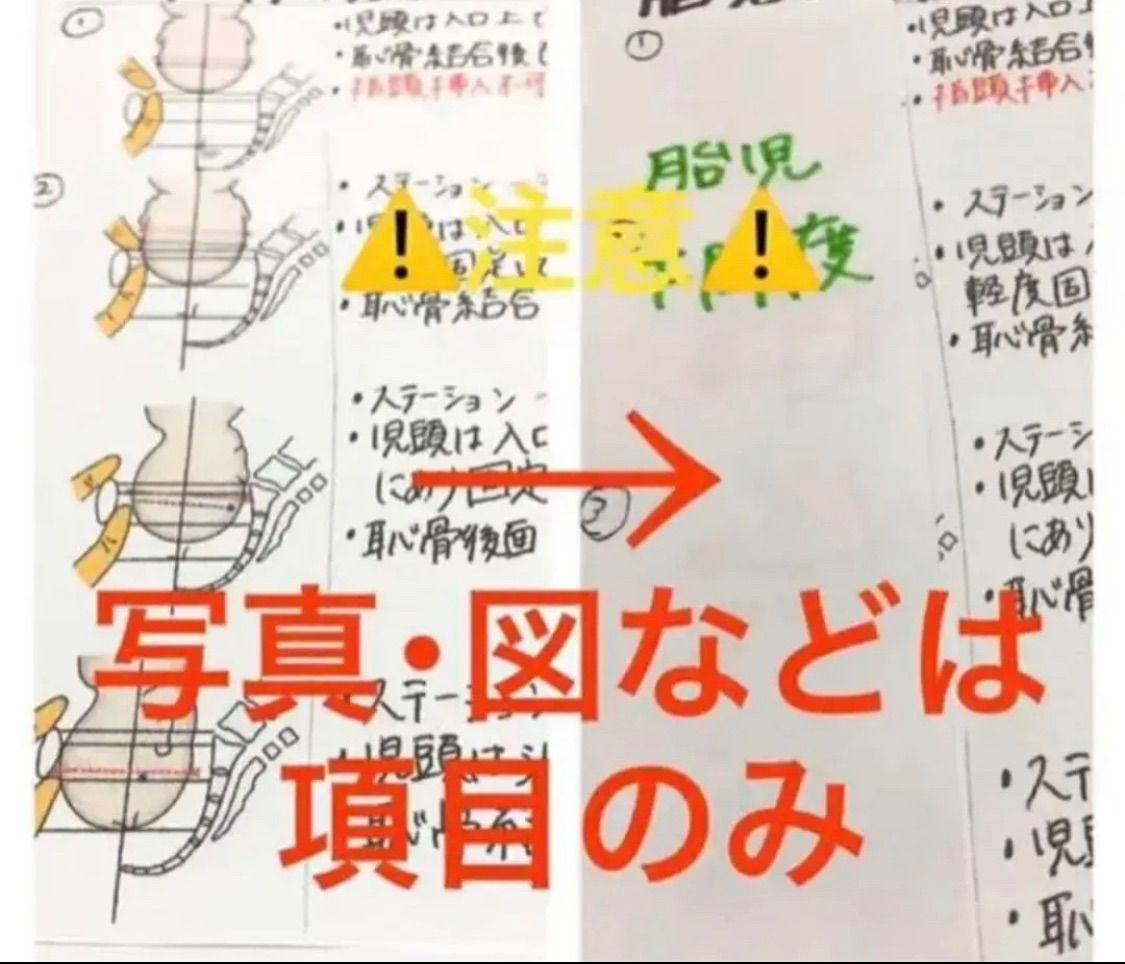 ☆ 看護師 看護学生 助産師 助産学生 ☆ 帝王切開術 まとめノート