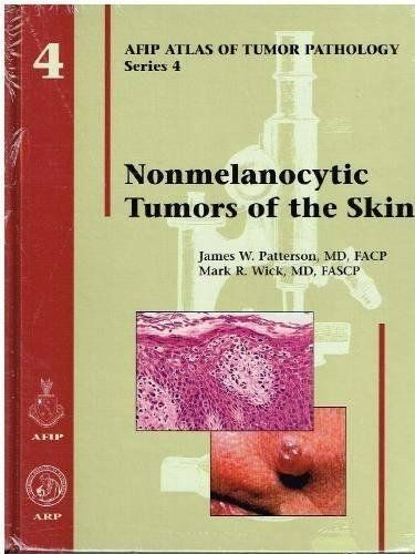 Nonmelanocytic Tumors of the Skin (Atlas of Tumor Pathology Series IV) [ハードカバー] Patterson，James W. Nonmelanocytic Tumors of the Skin (Atlas of Tumor Pathology