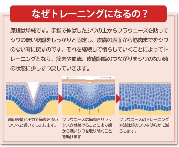 送料無料】フラウニーズ 額・眉間用 144ピース入り しわ取りシート