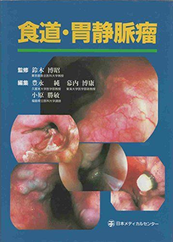 食道・胃静脈瘤 豊永 純