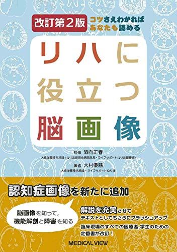 コツさえわかればあなたも読める リハに役立つ脳画像?改訂第2版／大村 優慈