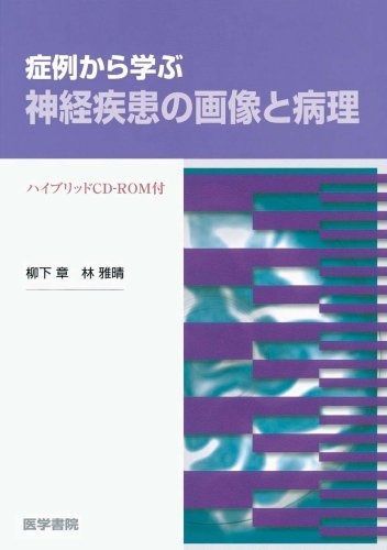 Top【選抜株】多肉植物 360434リップスティック 51個 鉢無し/脱土