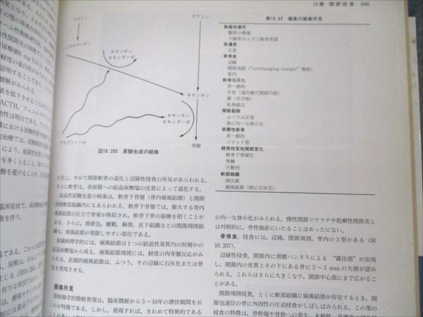 大系 骨