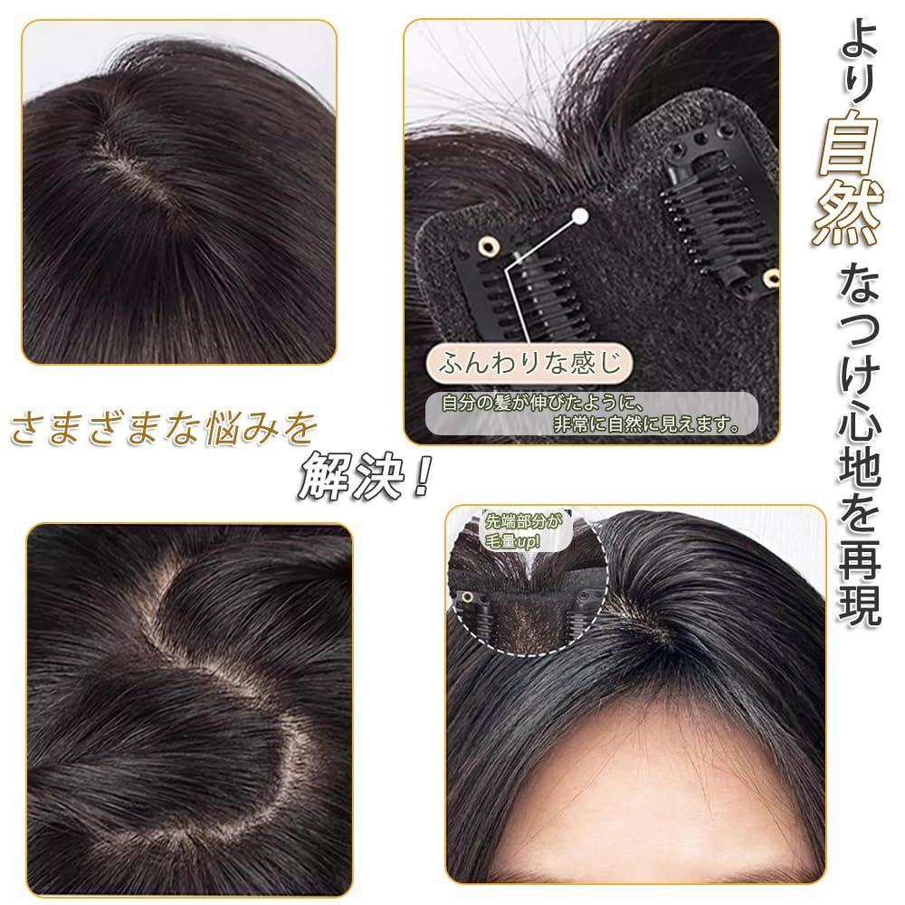 数量 医療用ウイッグ