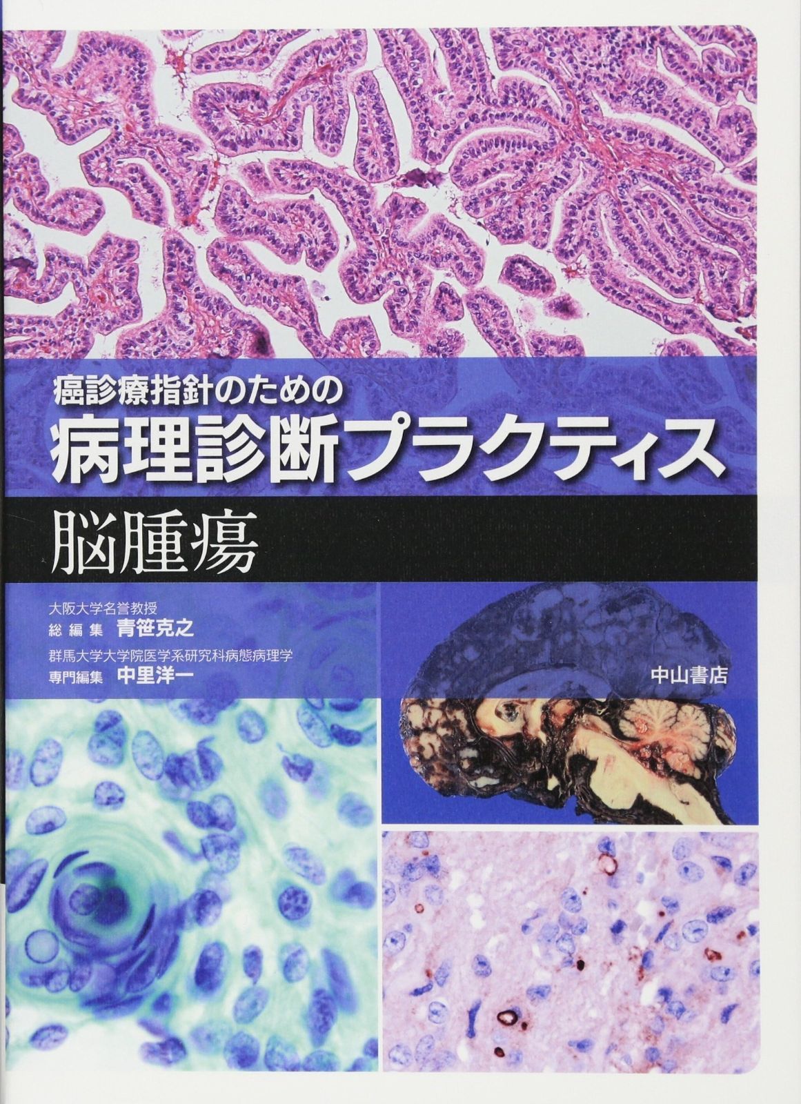 癌診療指針のための病理診断プラクティス リンパ球増殖疾患 [単行本] 克之， 青笹; 英一， 森井 919UJxqZYNL._UF350,350_QL50_.jpg