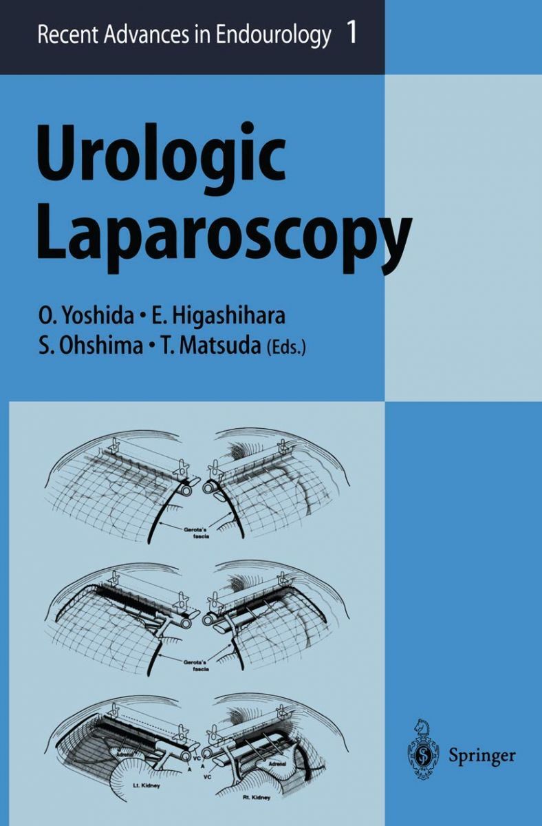 Urologic Laparoscopy (Recent Advances in Endourology) Yoshida， Osamu? Higashihara， Eiji? Ohshima， Shinichi; Matsuda， Tadashi Urologic Laparoscopy (Recent Advances in Endourology