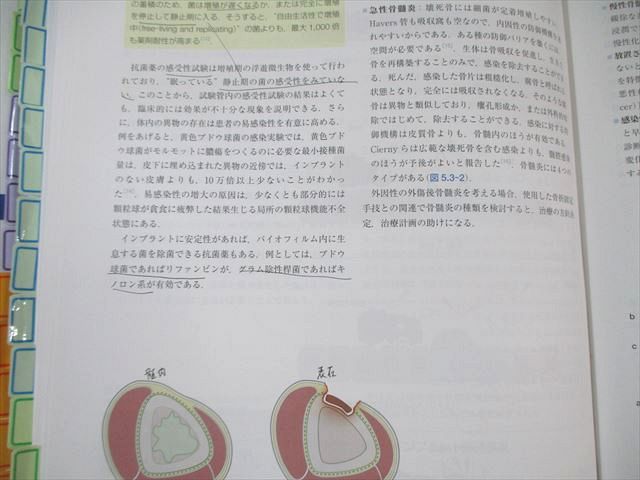 医学書院 AO法 骨折治療 第3版 2020 055R3D - メルカリ