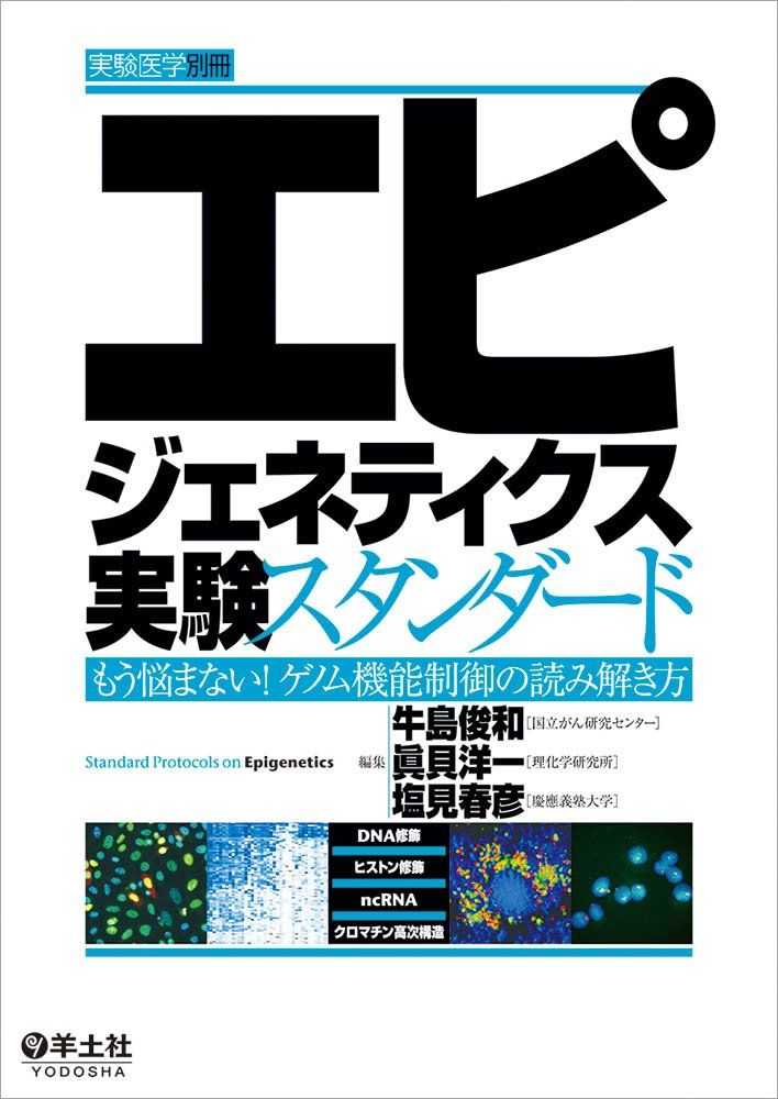 エピジェネティクス実験スタンダード?もう悩まない! ゲノム機能制御の読み解き方 (実験医学別冊)