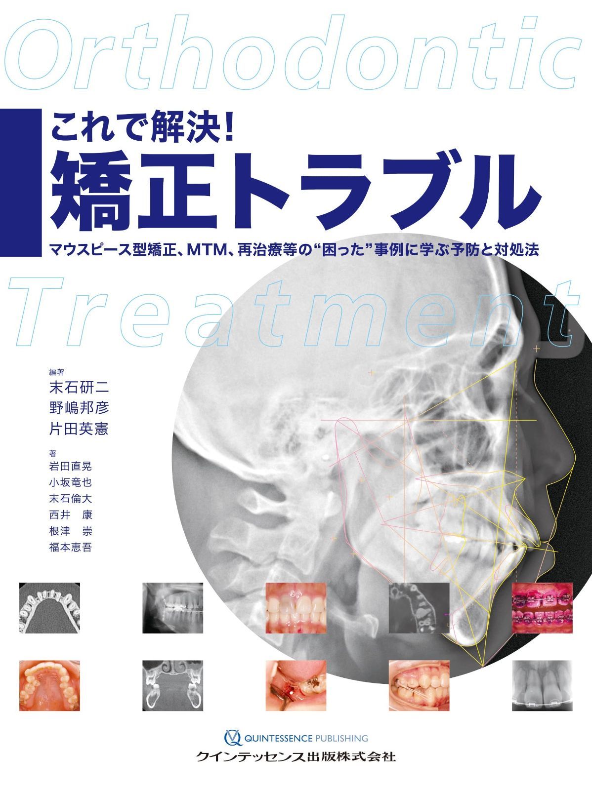 これで解決! 矯正トラブル これで解決! 矯正トラブル - 必見！矯正治療失敗の解決方法！！ メルカリ 神陵文庫