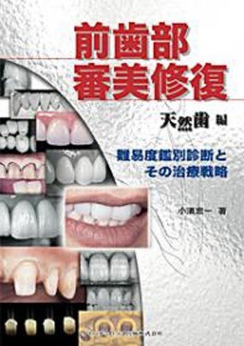 天然歯審美修復のセオリー 図解Q&A 前歯部審美修復 天然歯編 ―難易度鑑別診断とその治療戦略