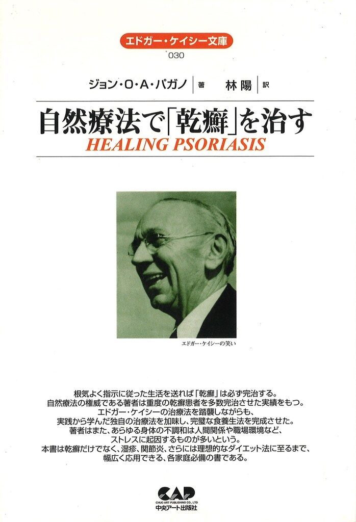 エドガー・ケイシーの乾癬治療 講座DVD 講師ジョン・バガノ Amazon.co.jp: 【DVD】ホリスティック医学の生みの親《エドガー