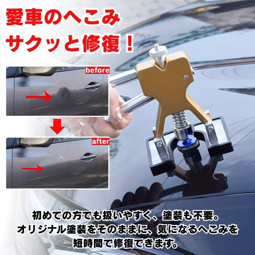 デントリペアツール デントリペアキット 車 へこみ直しリペアキット 工具 ツール 修理キット 工具 凹み カー バイク DIY 簡単 初心者 へこみ 自宅 プロ 修理 板金 整備 ドア ボディ ボンネット 車体 塗装 パテ 不要 吸盤 パッド フェンダー thumbnail 3
