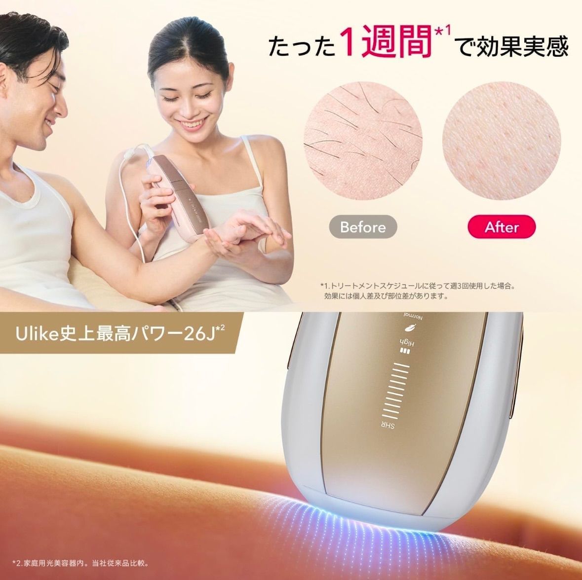 Ulike ユーライク Air 10脱毛器 ピンクゴールド　試用1回 Ulike ユーライク Air 10脱毛器 ピンクゴールド 試用1回のみ