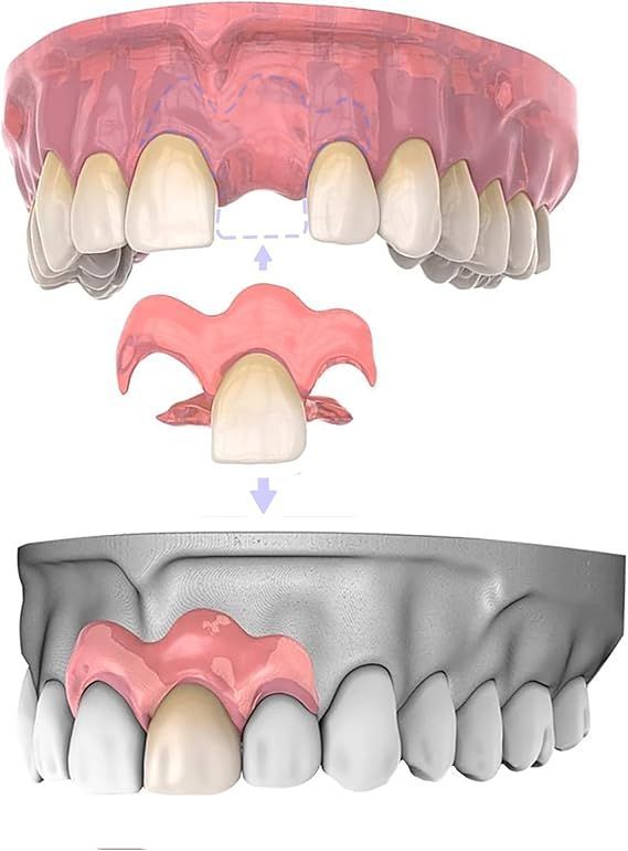 FORK&POPS 懐メロ　15枚セット FORK&POPS 懐メロ 15枚セット - メルカリ